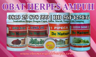 Illustration for article titled Pengobatan Alternatif Penyakit Herpes